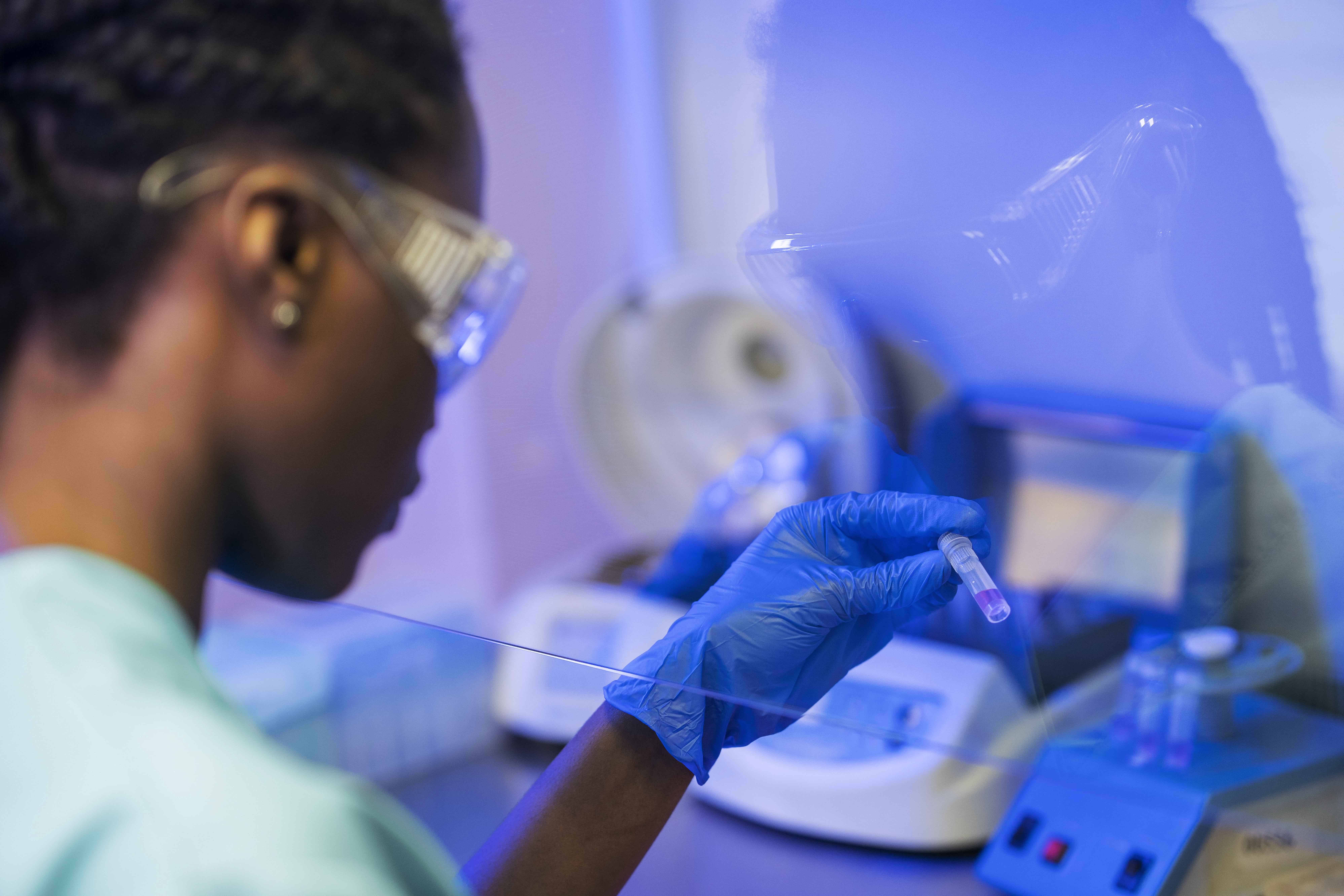 TP / TCA (Bilan de Coagulation)